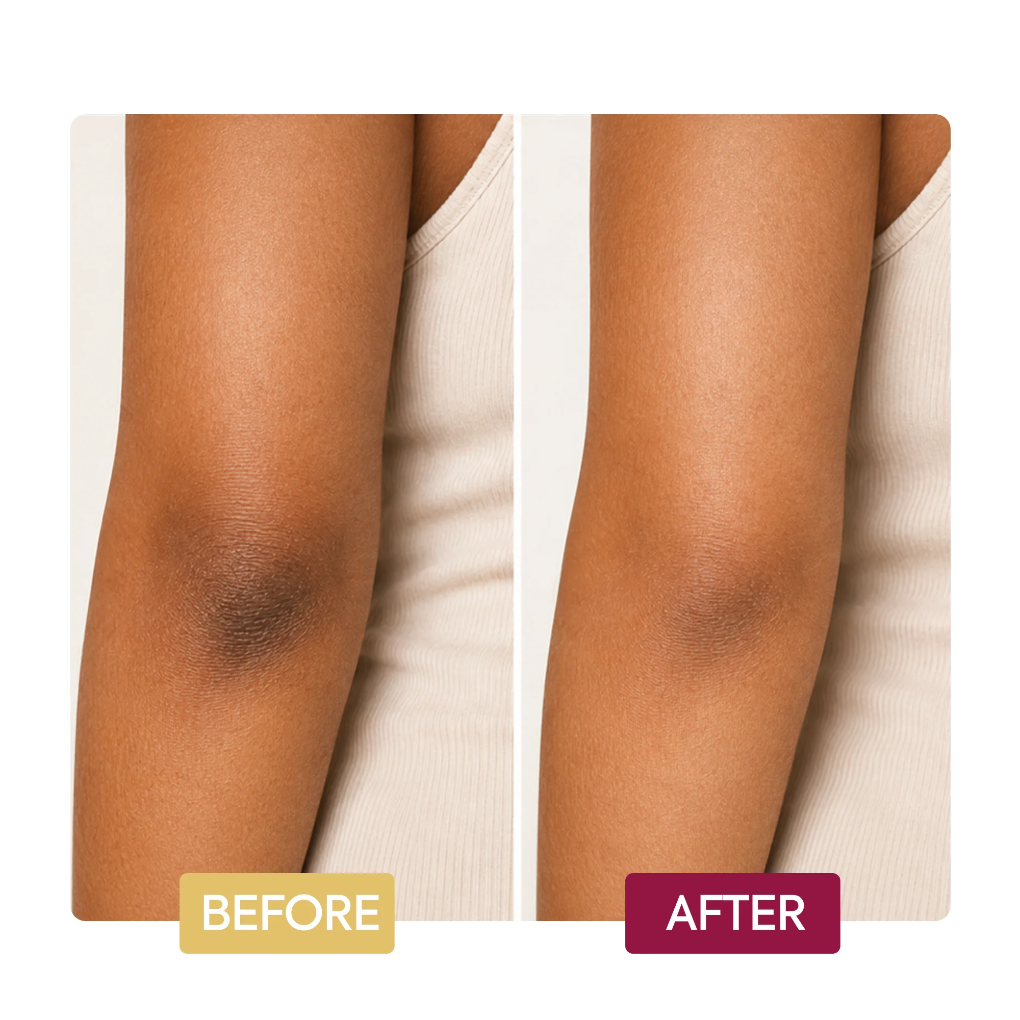 Clarifying Extreme Toning Cream Hand, Foot & Elbow - Image 6