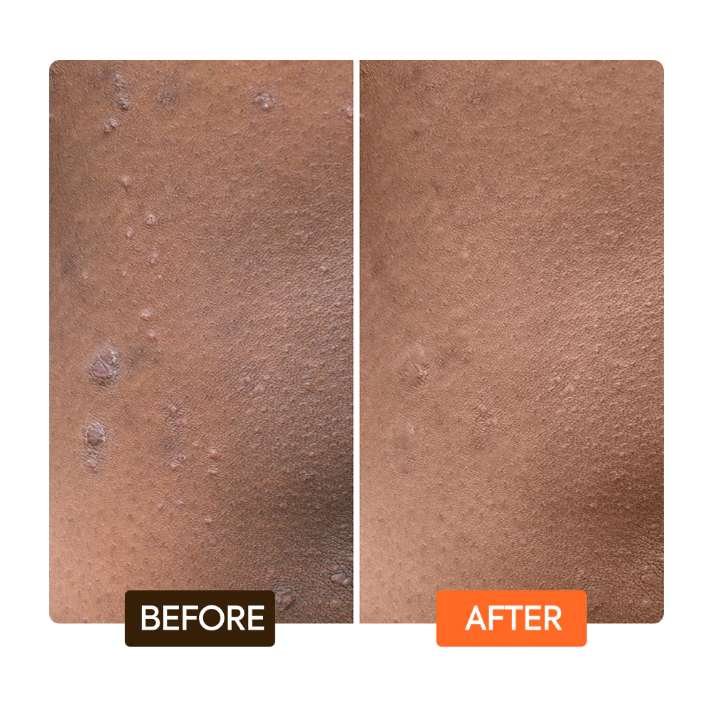 Extreme Argan Carrot Milk & Soap Kit - Image 4